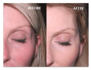 Wells Card Before After sandy voluma pdf 300x231 1