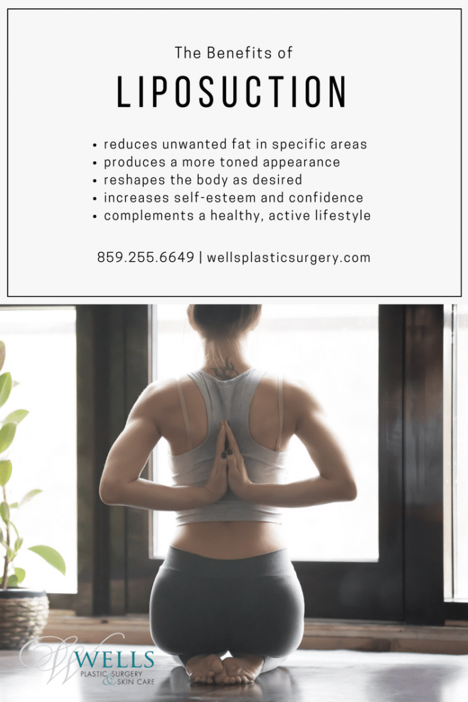 Wells LipoBenefits IG 683x1024 1