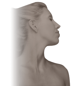 facelift img2