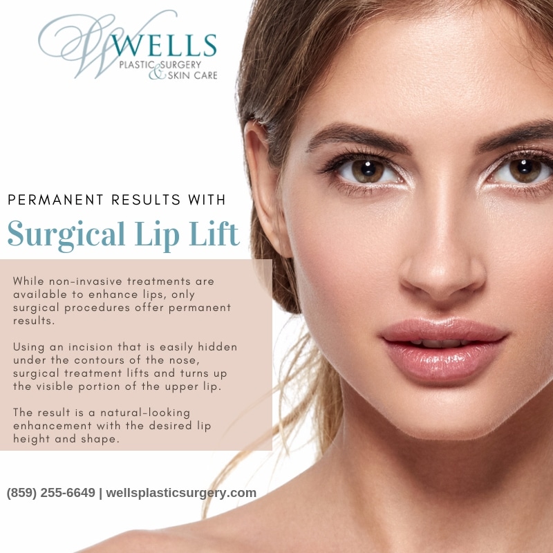 permanent results with surgical lip lift 5e957791cf6da