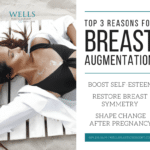 top 3 reasons for breast augmentation 5e9577b41af38
