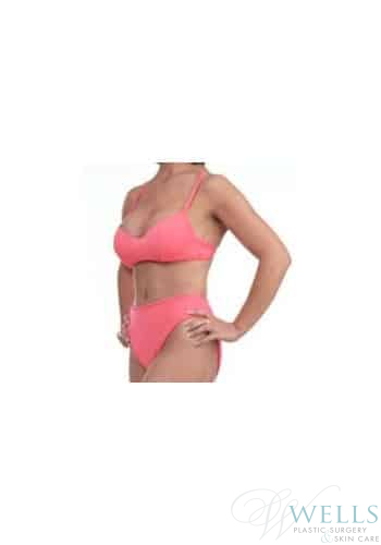 After Image: Comprehensive Makeovers - left-front-oblique
