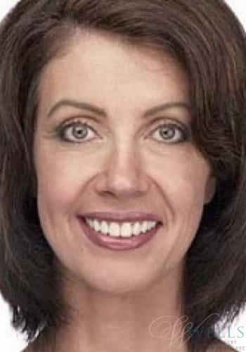 After Image: Comprehensive Makeovers - front