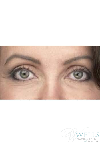 After Image: Comprehensive Makeovers - other