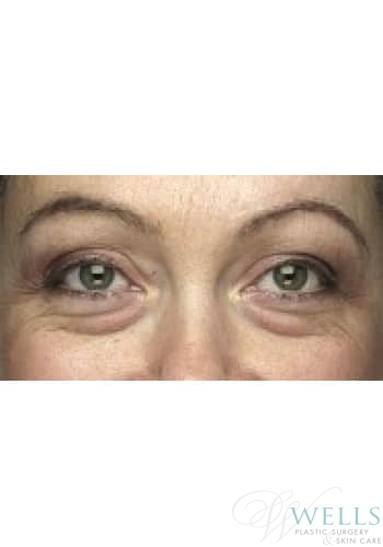 Before Image: Comprehensive Makeovers - other