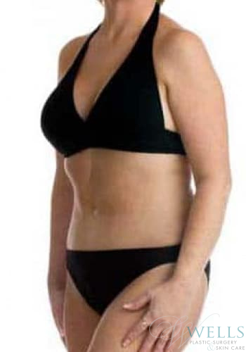 After Image: Comprehensive Makeovers - left-front-oblique