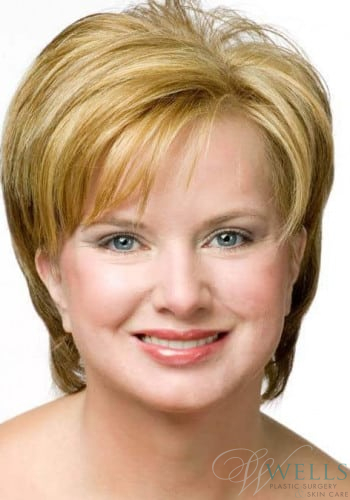 After Image: Comprehensive Makeovers - front