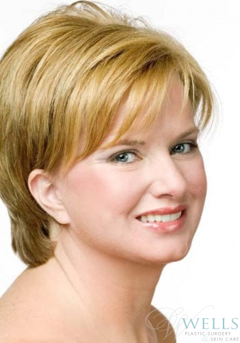 After Image: Comprehensive Makeovers - right-front-oblique