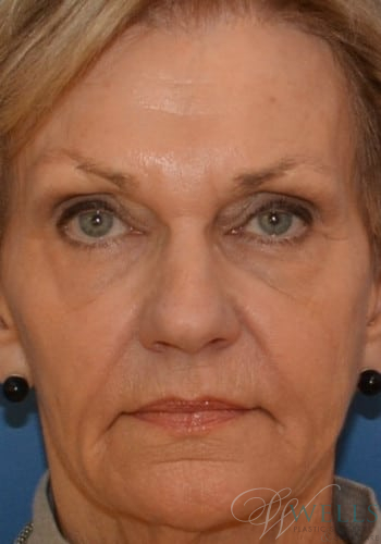 After Image: Combination Skin Care - front