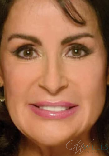 After Image: Combination Skin Care - front