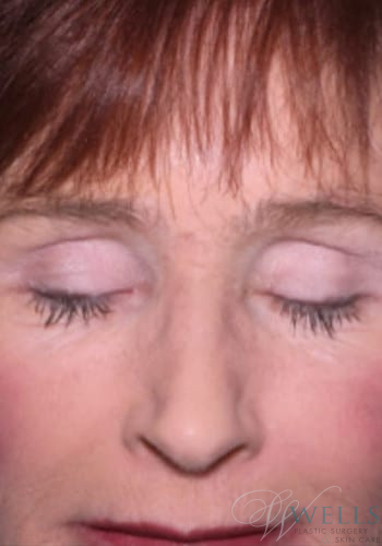 After Image: Combination Skin Care - front