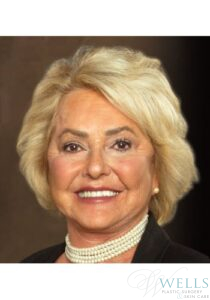 After Image: Facelift